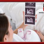 اهمیت سلامتی غربالگری جنین چیست و مراحل آن چگونه است؟