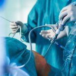انواع روش‌های جراحی زانو را بشناسید